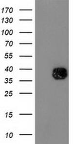 NDEL1 Antibody in Western Blot (WB)