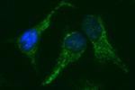 NDOR1 Antibody in Immunocytochemistry (ICC/IF)
