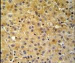 NDUFA10 Antibody in Immunohistochemistry (IHC)