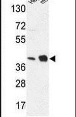 NDUFA10 Antibody in Western Blot (WB)