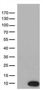 NDUFA2 Antibody in Western Blot (WB)