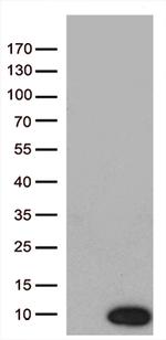 NDUFA2 Antibody in Western Blot (WB)