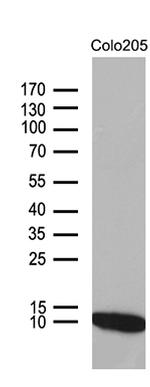 NDUFA4L2 Antibody in Western Blot (WB)
