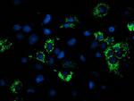 NDUFA7 Antibody in Immunocytochemistry (ICC/IF)