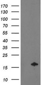 NDUFA7 Antibody in Western Blot (WB)