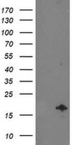 NDUFA7 Antibody in Western Blot (WB)