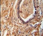 NDUFAF1 Antibody in Immunohistochemistry (IHC)
