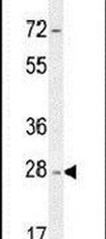 NDUFAF1 Antibody in Western Blot (WB)