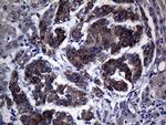 NDUFAF5 Antibody in Immunohistochemistry (Paraffin) (IHC (P))