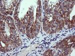 NDUFB10 Antibody in Immunohistochemistry (Paraffin) (IHC (P))