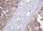 NDUFB10 Antibody in Immunohistochemistry (Paraffin) (IHC (P))