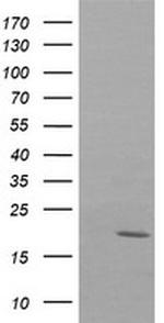NDUFB10 Antibody in Western Blot (WB)