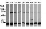 NDUFB10 Antibody in Western Blot (WB)