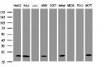 NDUFB10 Antibody in Western Blot (WB)