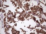 NDUFB11 Antibody in Immunohistochemistry (Paraffin) (IHC (P))
