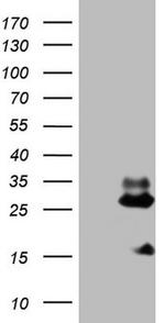 NDUFB11 Antibody in Western Blot (WB)