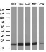 NDUFB11 Antibody in Western Blot (WB)