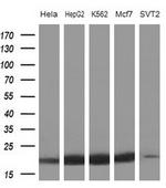 NDUFB11 Antibody in Western Blot (WB)