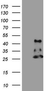 NDUFB11 Antibody in Western Blot (WB)