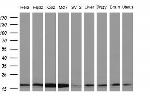 NDUFB11 Antibody in Western Blot (WB)