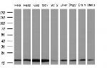 NDUFB11 Antibody in Western Blot (WB)