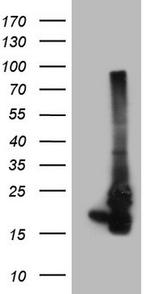 NDUFB11 Antibody in Western Blot (WB)