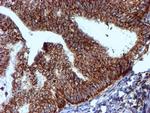 NDUFB9 Antibody in Immunohistochemistry (Paraffin) (IHC (P))