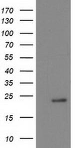 NDUFB9 Antibody in Western Blot (WB)