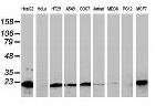 NDUFB9 Antibody in Western Blot (WB)