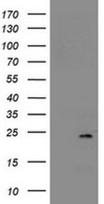 NDUFB9 Antibody in Western Blot (WB)