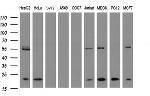 NDUFB9 Antibody in Western Blot (WB)