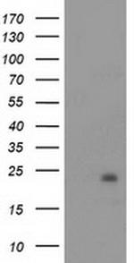 NDUFB9 Antibody in Western Blot (WB)