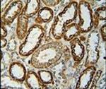 NDUFC2 Antibody in Immunohistochemistry (IHC)