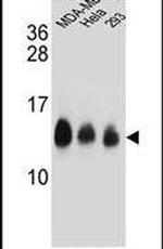 NDUFC2 Antibody in Western Blot (WB)