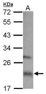 NDUFS7 Antibody in Western Blot (WB)