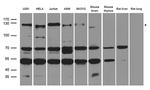 NEDD4 Antibody in Western Blot (WB)