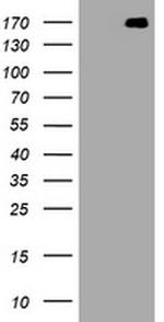 NEFH Antibody in Western Blot (WB)