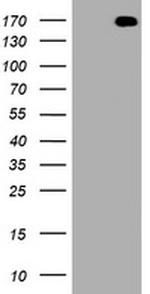 NEFH Antibody in Western Blot (WB)