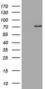 NEFL Antibody in Western Blot (WB)