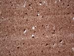 NEFM Antibody in Immunohistochemistry (Paraffin) (IHC (P))
