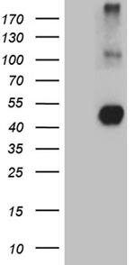 NEGR1 Antibody in Western Blot (WB)