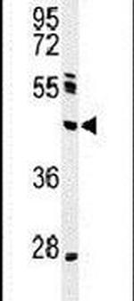NEIL1 Antibody in Western Blot (WB)