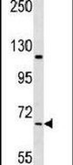 NEK11 Antibody in Western Blot (WB)