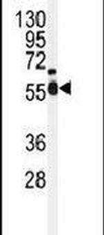 NEK2 Antibody in Western Blot (WB)