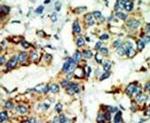 NEK4 Antibody in Immunohistochemistry (IHC)