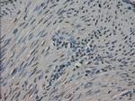 NEK6 Antibody in Immunohistochemistry (Paraffin) (IHC (P))