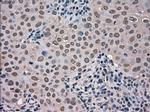 NEK6 Antibody in Immunohistochemistry (Paraffin) (IHC (P))
