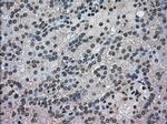 NEK6 Antibody in Immunohistochemistry (Paraffin) (IHC (P))