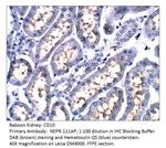 CD10 Polyclonal Antibody