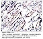 CD10 Polyclonal Antibody